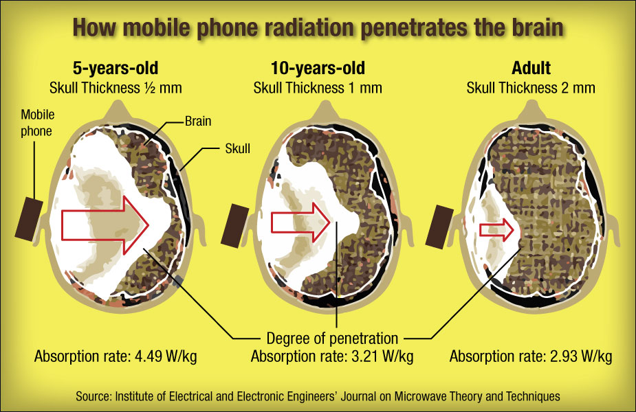 Images illustrant la profondeur de pénétration de l'onde émise par un téléphone portable dans la tête